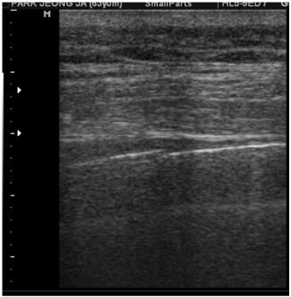 17051957121705195712786_6cac3cd87d4e3220eb6b.jpg